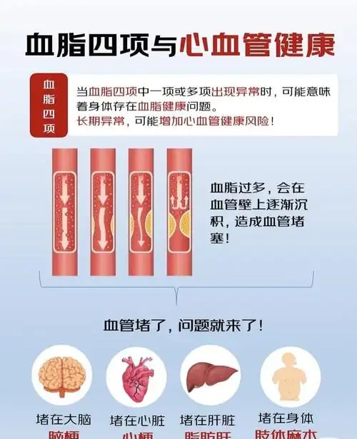 血脂异常管理